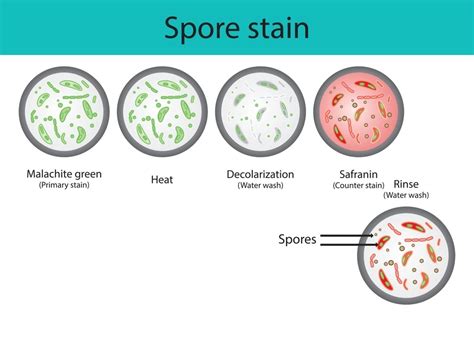 Endospore Staining: Principle, Procedure, Results.